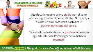 Stadi della Cellulite Vediamo in questo video i 6 Stadi Della Cellulite [upl. by Ahsema]