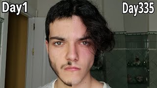 Me dejo crecer el cabello por 1 añoPelo largo hombre crecimiento [upl. by Spillihp]