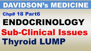 Davidsons Medicine Chp18 Part6  Endocrinology  Thyroid LUMP  Subclinical Thyroid Issues [upl. by Tammie]