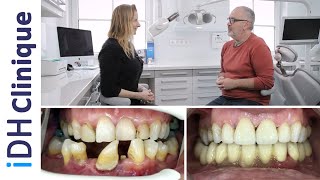 Refaire des dents mal alignées  iDH Clinique  Dr Szrebro [upl. by Analihp169]