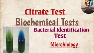 Citrate Test ll Biochemical Tests ll Bacterial identification test ll Microbiology [upl. by Nahsrad]