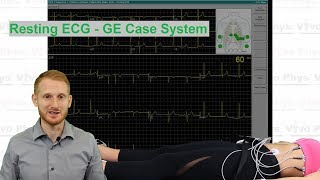 Resting ECG  GE Case System [upl. by Atterual]