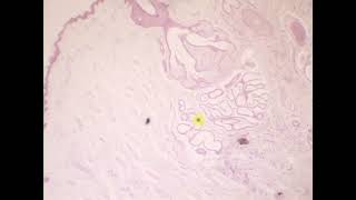 Stratified squamous epithelium with thin keratin upper eyelid [upl. by Roma]