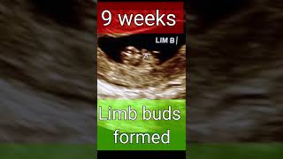 Ultrasound 511 weeks gestationbaby in wombshortvideoDrhome [upl. by Philander]