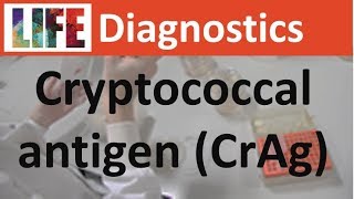 Cryptococcal antigen CrAg testing  Biosynex CryptoPS [upl. by Ahsayn]