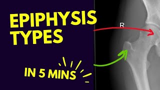 Types of Epiphysis 🦴  In FIVE 5️⃣ Minutes [upl. by Nylekcaj]