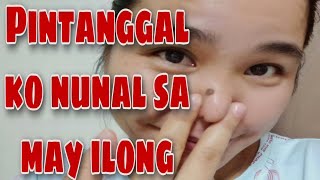 PINATANGGAL KO NUNAL SA MAY ILONG [upl. by Elwira76]