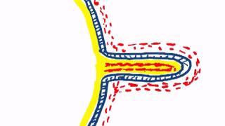 chorionic villi by dr sameh ghazy [upl. by Joaquin199]