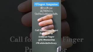 Finger Amputee Best Treatment is Silicone Finger Prosthesis Only 919910213766 Anaplastology [upl. by Hoj756]