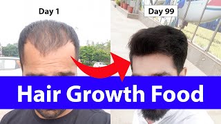 How to Regrow Hair in 99 Days [upl. by Mcginnis]