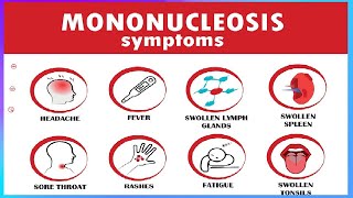 👀Mononucleosis Kissing Disease👄 Symptoms and Treatment🩺Many people are exposed to EBV as kids🔴 [upl. by Ennoryt]