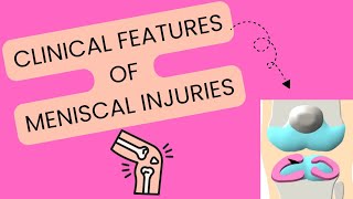 Clinical features of meniscal injuries  Important for physiotherapy students [upl. by Mcferren]