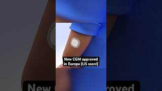 Simplera CGM from Medtronic receives CE Mark in Europe [upl. by Yelbmik]