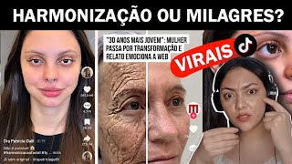 💉Reagindo aos Antes e Depois dos Procedimentos Faciais que VIRALIZARAM harmonizaçãofacial react [upl. by Haletky]