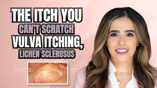 The Itch You Can’t Scratch Vulvar Itching Lichen Sclerosus [upl. by Anallese854]