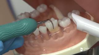 Cavitron Insert Portfolio  Dentsply Sirona [upl. by O'Driscoll]