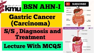 Gastric Cancer In UrduHindi  Gastrointestinal Tract Disorders  AHNI  Diagnosis and Treatment [upl. by Waylen]