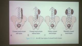 Embryology of the Urogenital System lecture  Urology  surgery  6th grade [upl. by Mariken]