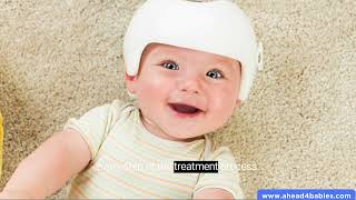 Positional Plagiocephaly Helmet Flat Head Infant Treatment [upl. by Robet]