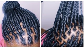 HOW TO DO YARN BRAIDS THE BEST BOX BRAIDING TECHNIQUE [upl. by Lingwood]