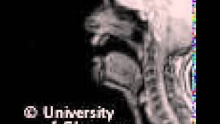 MRI voiceless alveolarlateral click [upl. by Nylidam]