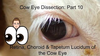 Cow Eye Dissection Part 10 Retina Choroid amp Tapetum Lucidum anatomy and physiology lesson [upl. by Erbas]