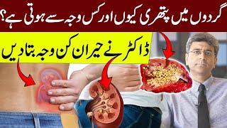 Why And What Causes Kidney Stones  Doctor Explained the Surprising Reason  Kidney Stone Pain [upl. by Air]