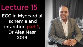 ECG from A to Z 015Alaa nasr2019myocardial ischemia and infarction part 1 [upl. by Fosdick678]