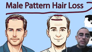 Understanding Male Pattern Hair Loss Causes and Treatments [upl. by Jaylene710]