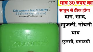 ketoconazoleketoconazole shampooketoconazole soapketoconazole cream [upl. by Sedecram]