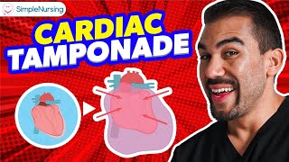 Cardiac Tamponade NCLEX Tips for Nursing Students [upl. by Eidur]