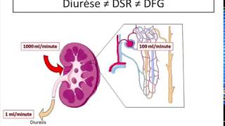 oligurie et sepsis [upl. by Victoir]