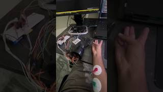 EMGBased Robotic Arm Control [upl. by Sheeb]