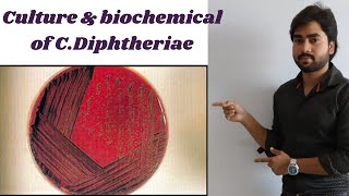 Corynebacterium  CDiphtheriae  Lab Diagnosis  Culture  Biochemicals By Abhishek sir [upl. by Wallach]