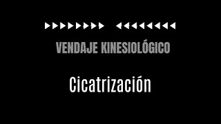 Vendaje Kinesiológico para cicatrización [upl. by Gerti502]