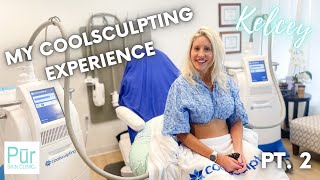 MY COOLSCULPTING EXPERIENCE PT 2  Flanks Treatment  Pūr Skin Clinic [upl. by Neils]