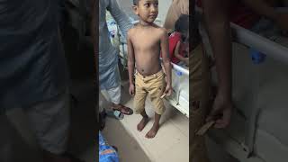 Musculoskeletal System Examination of Children পিজি হাসপাতালবিএসএমএমইউPaediatric Examination [upl. by Bohrer]