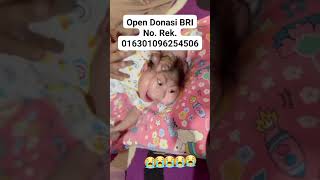 BAYI AJAIB BAYI VIRAL BAYI ANUGRAH BAYI TERLAHIR TANPA TEMPURUNG KEPALA SUBHANALLAH KUASA ALLAH SWT [upl. by Ordnagela]