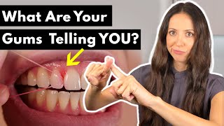 Why Do Gums HURT amp BLEED After Flossing [upl. by Chuah]