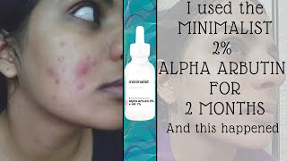 MINIMALIST ALPHA ARBUTIN 2 MONTH REVIEW [upl. by Neitsabes]