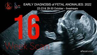 16 Week Anomaly Scan  EARLY DIAGNOSIS of FETAL ANOMALIES 2022 [upl. by Amalea]