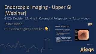 GIEQs Decision Making in Colorectal Polypectomy Taster video [upl. by Tonia]