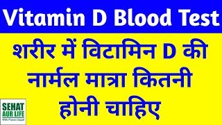 Vitamin D Blood Test Normal Range Hindi 25 Hydroxyvitamin D Test Normal Range Hindi [upl. by Matthews]