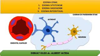 video 72 Jenis Edema Otak [upl. by Vinay]