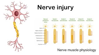 Nerve injury  Sedon and Sunderland classification of nerve injury [upl. by Hodgkinson]