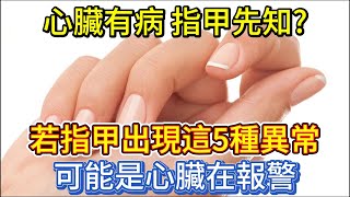 心臟有病，指甲先知？若指甲出現這5種異常，可能是心臟在報警 [upl. by Vary]