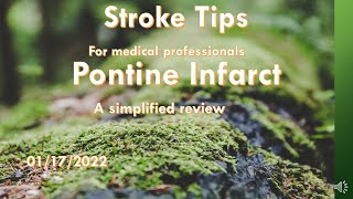 Stroke Tips Pontine infarct a simplified review [upl. by Russon870]