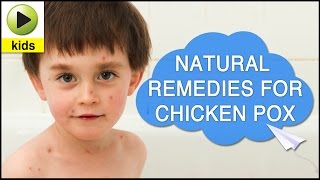 Kids Health Chicken Pox  Natural Home Remedies for Chicken Pox [upl. by Anerul]