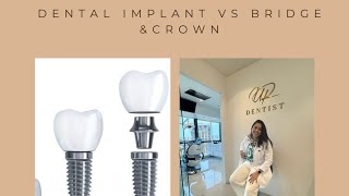 Dentist In Ulwe explains Dental Implants Dental Implants treatment UR DENTIST ULWE [upl. by Kristien]