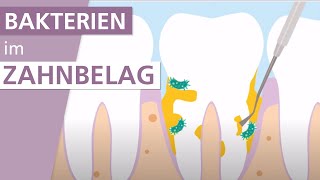 Behandlung von Parodontitis  Stiftung Gesundheitswissen [upl. by Candie]